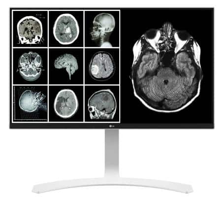 Best monitors for radiology and medical use