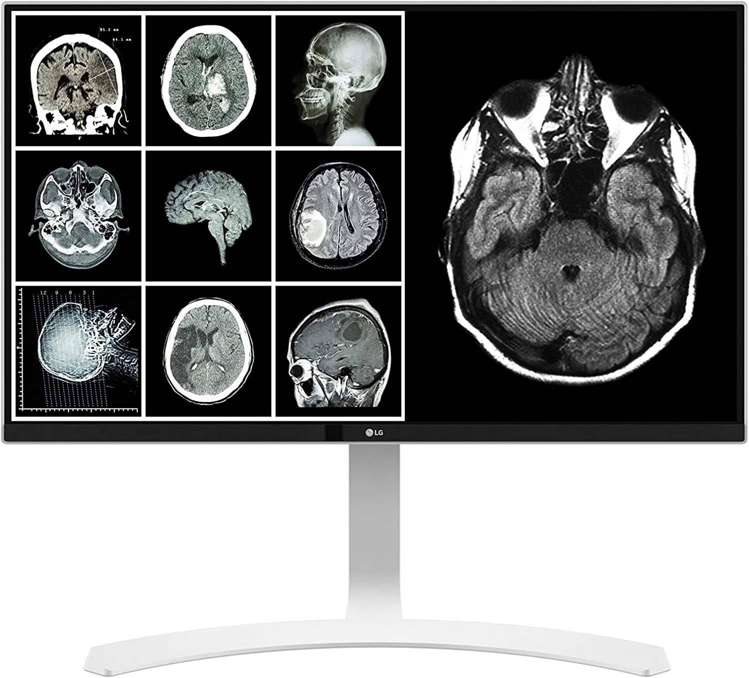 LG LED 27HJ712C-W Radiology Monitor Hero